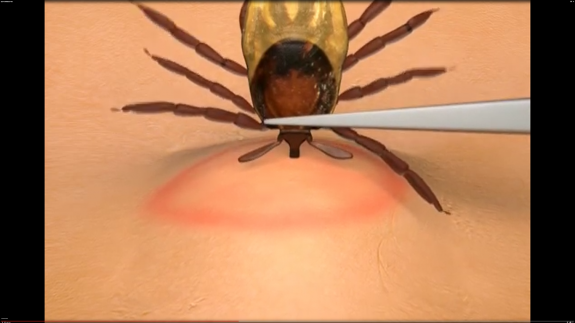 Screenshot 2017-07-08 07.07.24